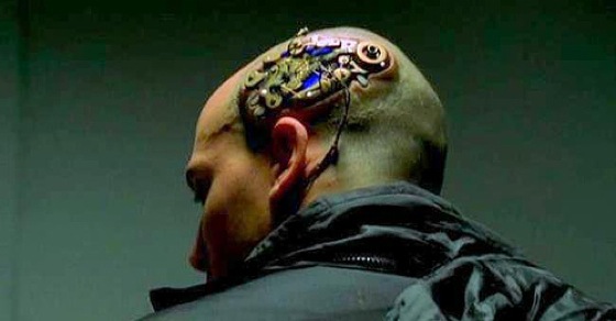 brain-implant
